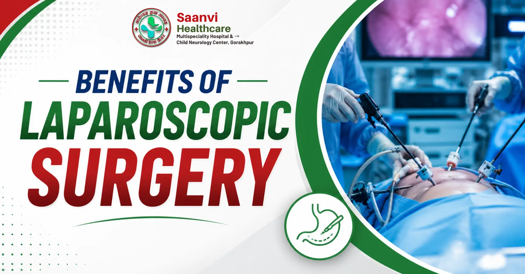 Benefits of Laparoscopic Surgery: Why Minimally Invasive Surgery is Becoming the Preferred Choice