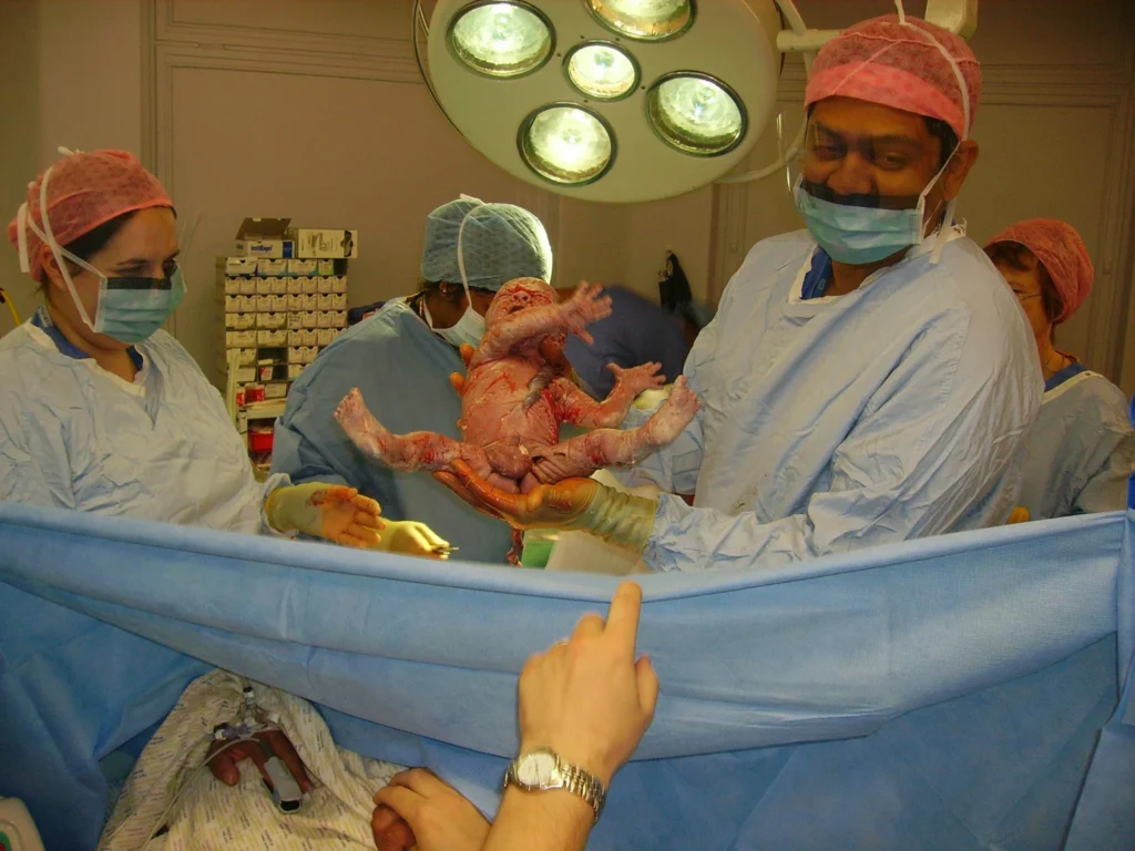 Gynecology and obstetrics surgical care at Saanvi Healthcare in Gorakhpur