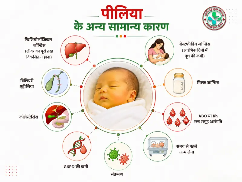 Newborn jaundice के सामान्य कारण जैसे physiological jaundice, breastfeeding jaundice, infection, G6PD deficiency, cholestasis और biliary atresia
